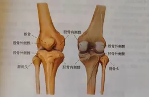 走路时膝盖突然发软，是怎么回事？专家为您解答